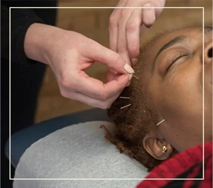 Home 28 a female patient receiving dry needling treatment in her head at Active Edge Columbus Ohio