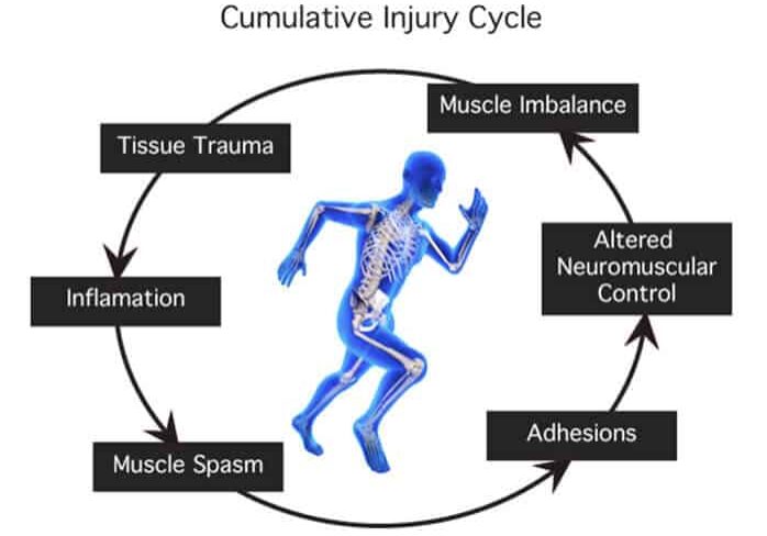 cumulative_injury-cycle