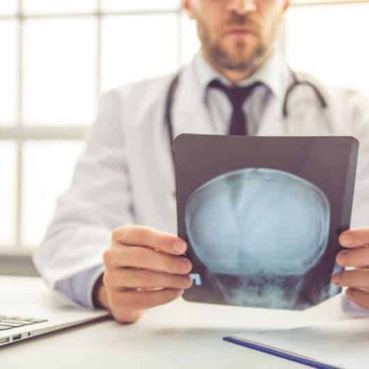 doctor examining an X-ray of a patient's skull