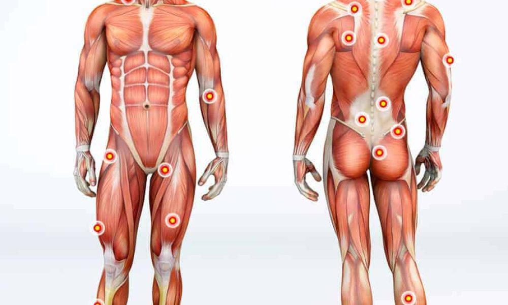 Fascia Human Body Diagram showing knots and pain points